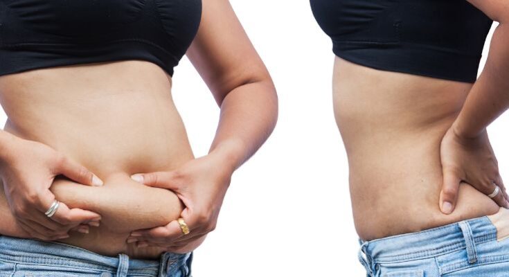 HIEMT alakformáló és intimpad kezelés Biatorbágyon