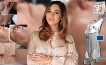 Hatékony megoldás a bőrfiatalításra Debrecenben